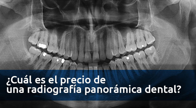 cual-es-el-precio-de-una-radiografia-panoramica-dental