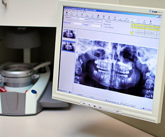radiografia dental digital