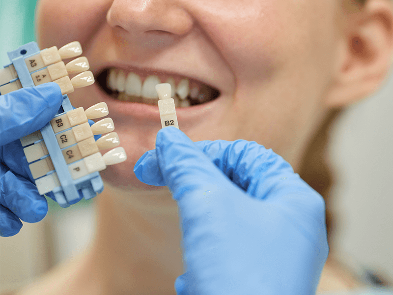 despues-de-un-implante-dental-se-puede-trabajar