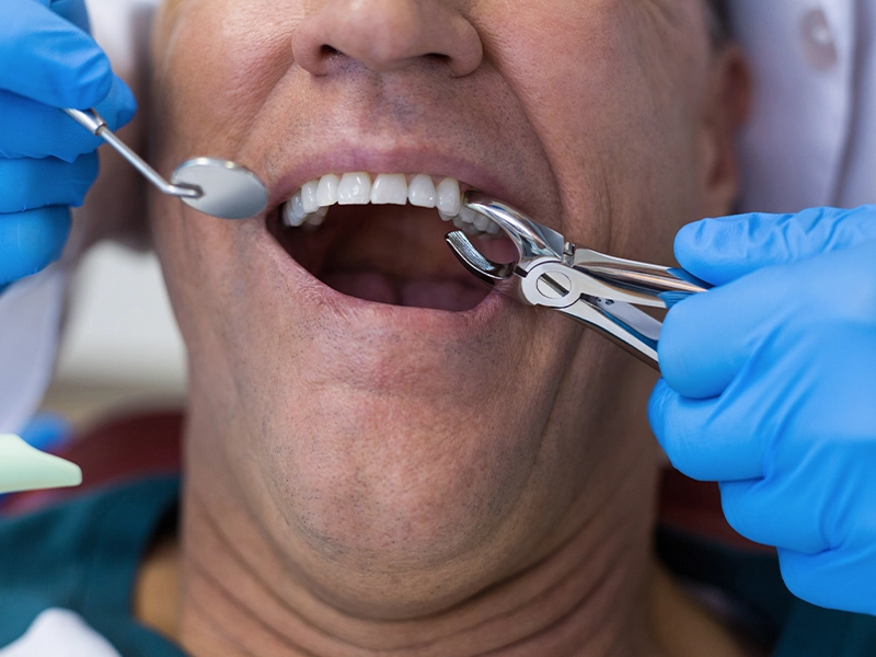 cuales-suelen-ser-los-tratamientos-dentales-mas-comunes-dentista-tijuana
