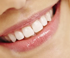 para-optimizar-la-higiene-y-salud-de-tu-boca-se-recomienda-incluir-el-uso-de-hilo-dental-y-enjuague-bucal-en-la-rutina-del-cepillado-dentista-tijuana