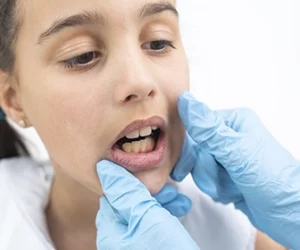 un-tratamiento-de-ortodoncia-ya-que-si-no-se-cuida-adecuadamente-pueden-aparecer-manchas-dentista-tijuana