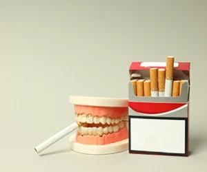 blanqueamiento-dental-para-fumadores