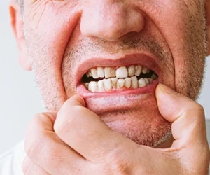 tratamiento-y-cirugia-de-condiciones-que-afectan-la-cara-la-mandibula-y-la-cavidad-oral-dentista-tijuana