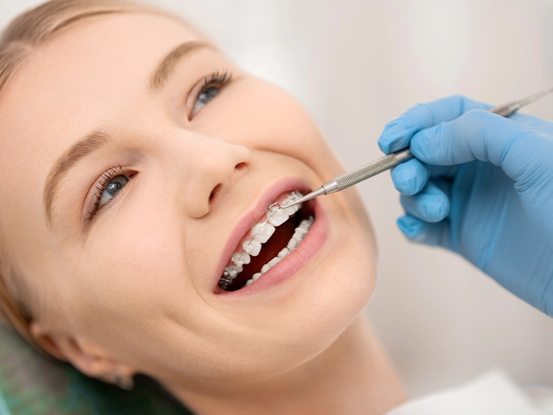 descubre-cuanto-tiempo-dura-un-tratamiento-de-ortodoncia-dentista-tijuana