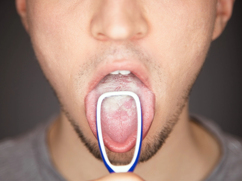 medidas-de-higiene-de-la-lengua-son-realmente-necesarias-dentista-tijuana